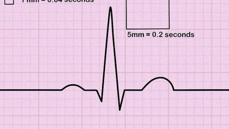 How to Read an EKG