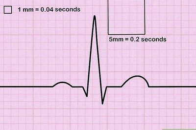 How to Read an EKG