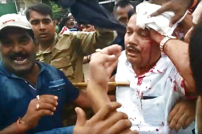 BJP MP Arjun Singh Suffers Head Injuries During Clash, Claims Cops Baton Charged Him