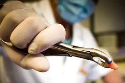 UK Man, Who Couldn't Get Dentist Appointment For 10 Years, Pulls Out His Teeth