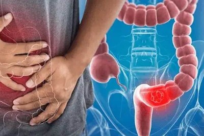 Early Indicators of Bowel Cancer That You Should Not Overlook