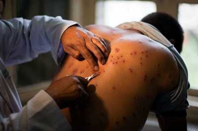 After Severe Eye Injuries, Army to Use Modified Pellet Guns in Kashmir