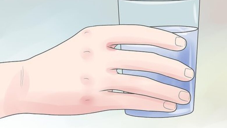 How to Ease Glandular Fever Symptoms
