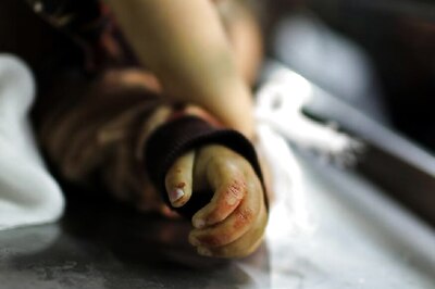 India Saw Second-highest Number of Pneumonia Deaths of Children Under Age Five: UN