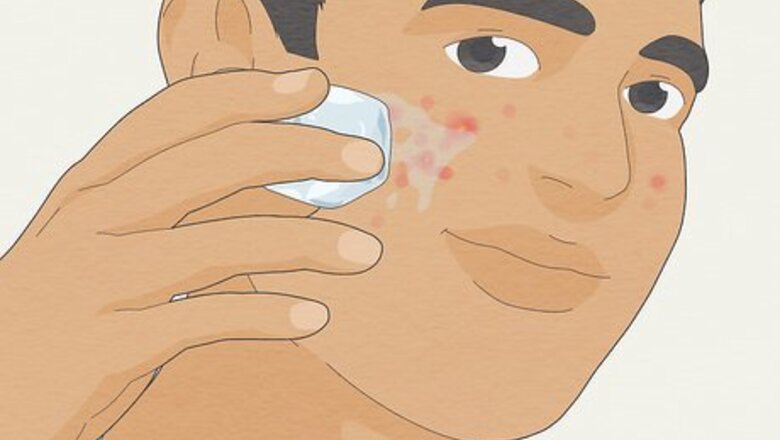 The Best Ways to Get Rid of Pimples and Reduce Acne Fast