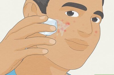 The Best Ways to Get Rid of Pimples and Reduce Acne Fast