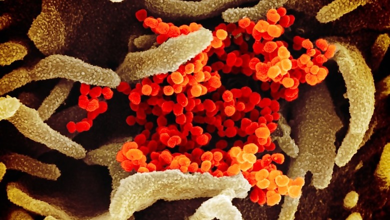 Temperature, Humidity Affects Survival of Virus, C-section May Raise Risk for Infected Mothers: IIT-B