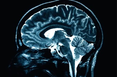 Brain injury may be present even without symptoms