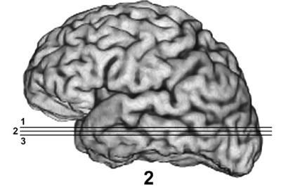Multitasking may damage your brain: Study