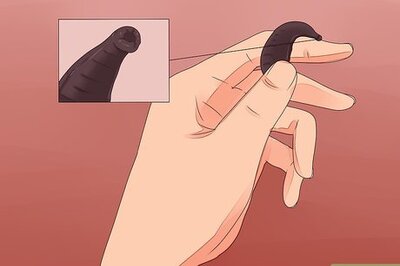 How to Remove a Leech