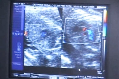 States asked to develop online portals to report prenatal sex determination