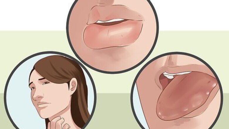 How to Diagnose Oral Allergy Syndrome