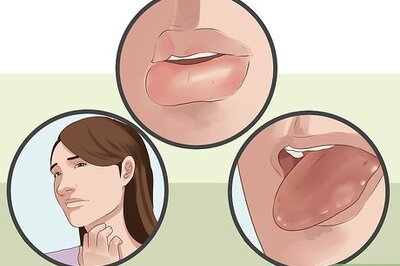How to Diagnose Oral Allergy Syndrome