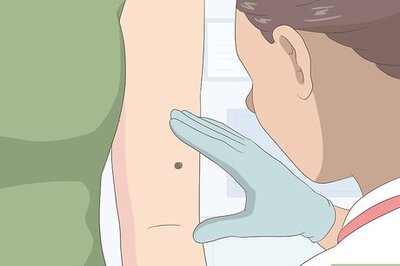 The Quickest Methods for Mole Removal