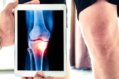 What Is Baker Cyst? Know Its Causes, Symptoms And Treatment