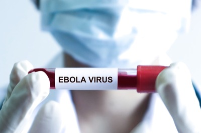 What is Ebola Virus Which Has Triggered Outbreak in Uganda? All About Spread, Symptoms & Treatment