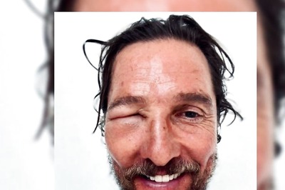 Matthew McConaughey Suffers From Severe Bee Stunt; Fans Wish Speedy Recovery