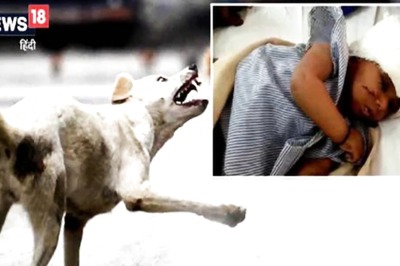 In Madhya Pradesh's Ujjain, One-Year-Old Girl Bitten By Stray Dogs; Condition Critical