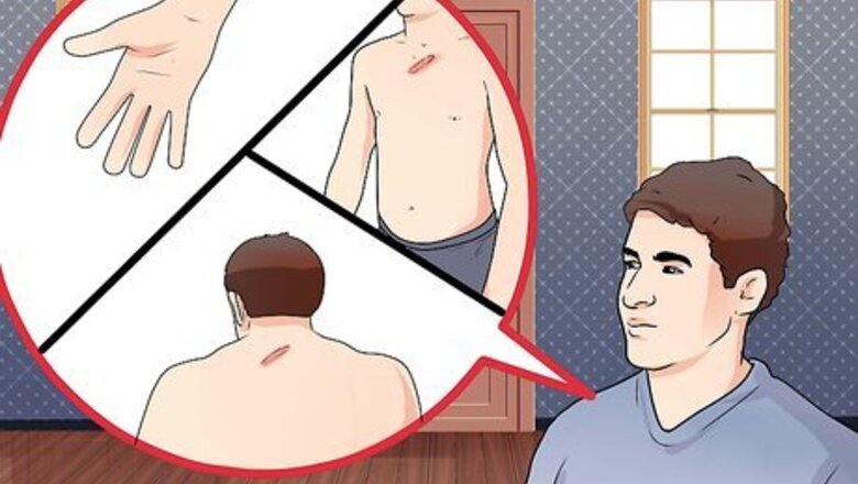 How to Prevent Keloid and Hypertrophic Scars