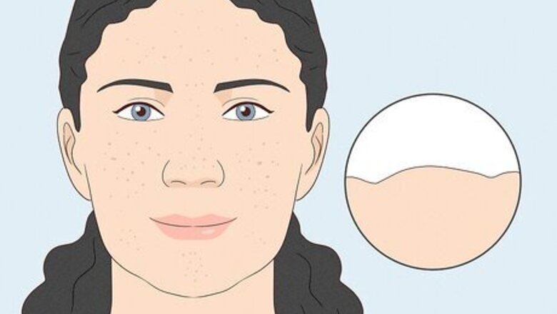 How to Get Rid of Orange Peel Skin on the Face & Body