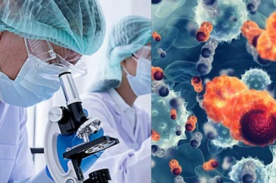 Panel of 10 Sex-Specific Proteins Can Detect 18 Early-Stage Cancers: New Study