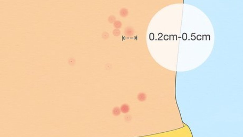 How to Identify Bed Bug Bites