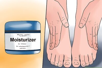 How to Treat Winter Eczema