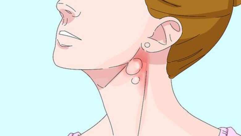 How to Diagnose Lymphoma