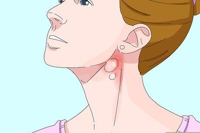 How to Diagnose Lymphoma