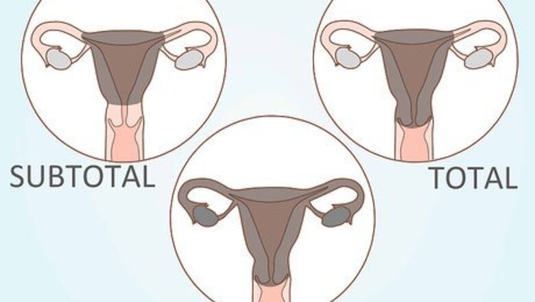 How to Prepare for a Hysterectomy