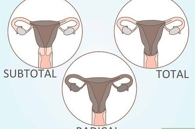 How to Prepare for a Hysterectomy