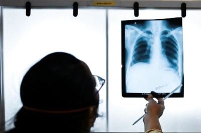 India Rejects J&J Plea to Extend Patent on Key Tuberculosis Drug, Drop in Prices Expected