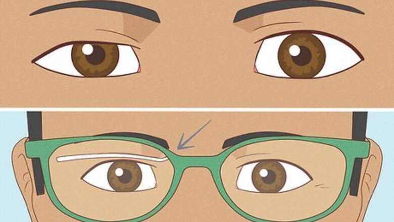 How to Fix Asymmetrical Eyes