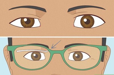 How to Fix Asymmetrical Eyes