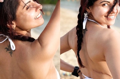 Chhavi Mittal Embraces Breast Cancer Surgery Scar In Gorgeous Bikini Pics, Says ‘This Is What I Earned…’