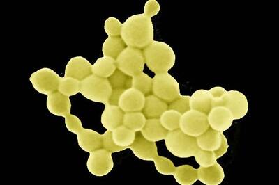 These Bacteria Turn Toxic Metals Into Gold Nuggets