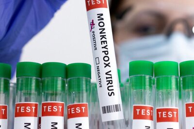 Exclusive | Delhi Well-Prepared for Monkeypox, Too Early to Predict Surge: LNJP Hospital Head