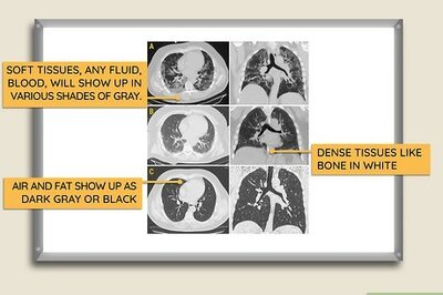 How to Read a CT Scan