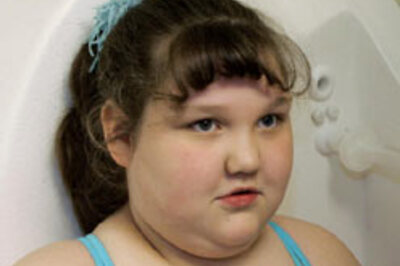Childhood obesity triggers early puberty