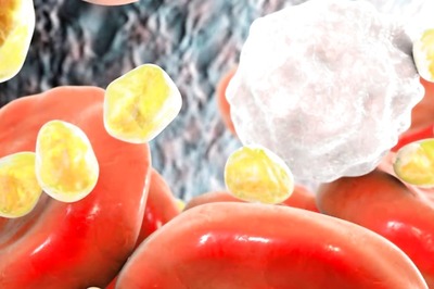 Planning To Get A Cholesterol Test Done? Here’s Are Few Things To Keep In Mind