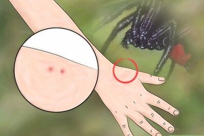 How to Identify a Spider Bite