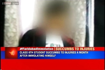Faridabad: Student succumbs to burns