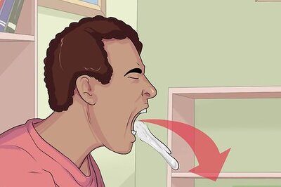 How to Treat Tongue Burn Blisters