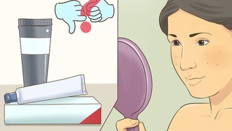 How to Know if You Need a Prescription Acne Treatment