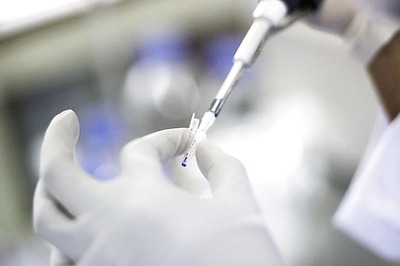 Chhattisgarh Reports Outbreak of Highly Contagious H5N1 Bird Flu: World Organisation for Animal Health