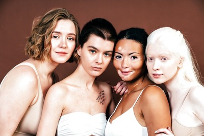 International Albinism Awareness Day 2021: Theme, History and Significance