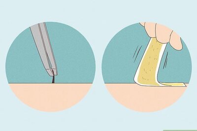 How to Get Rid of Dark Spots from Shaving