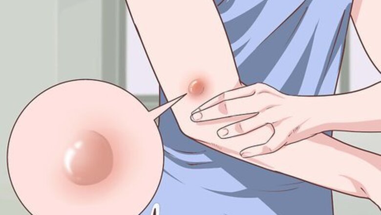 How to Handle a Rheumatoid Arthritis Skin Problem