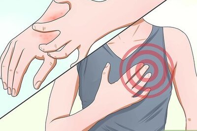 How to Treat Morgellon's Disease