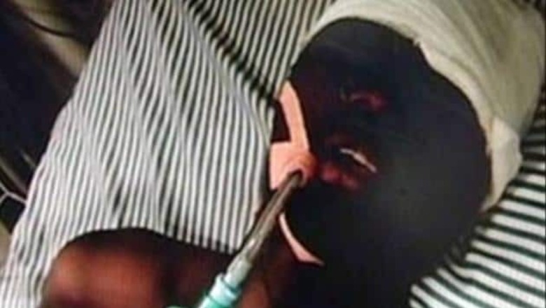 Accused in Burundi student case sent to custody